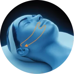 EMface facial toning Dublin - 3D head diagram showing the lower cheeks 3D head diagram showing the lower cheeks for EMface facial toning in Dublin