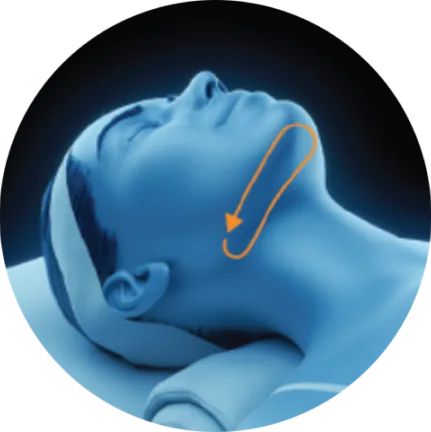 EMface facial toning Dublin - 3D head diagram showing the area under the chin 3D head diagram showing the area under the chin for EMface facial toning in Dublin